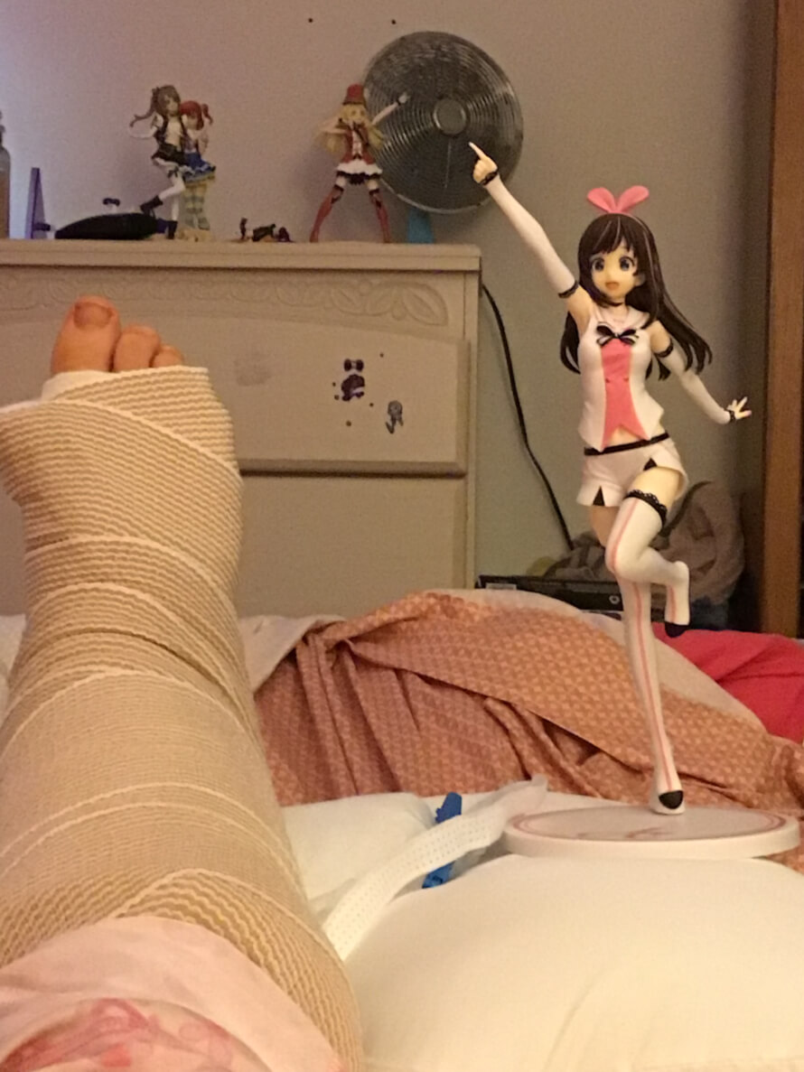 I’m about to head to the hospital for surgery!!! I love you fam!!

Edit: Hi ya’ll, it went well!...