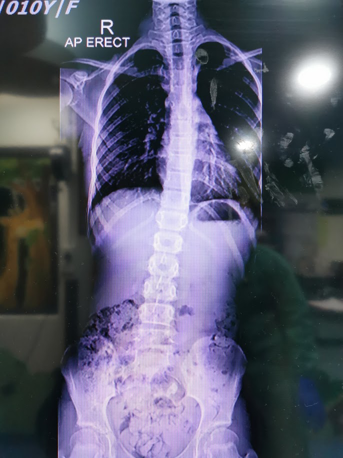 this is how i became a terrible bandori player